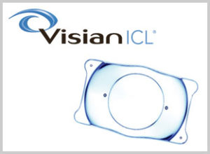 Visian ICL™ Lens Example